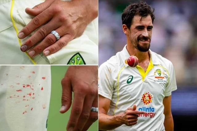 Starc out from 3rd Test against South Africa due to finger injury